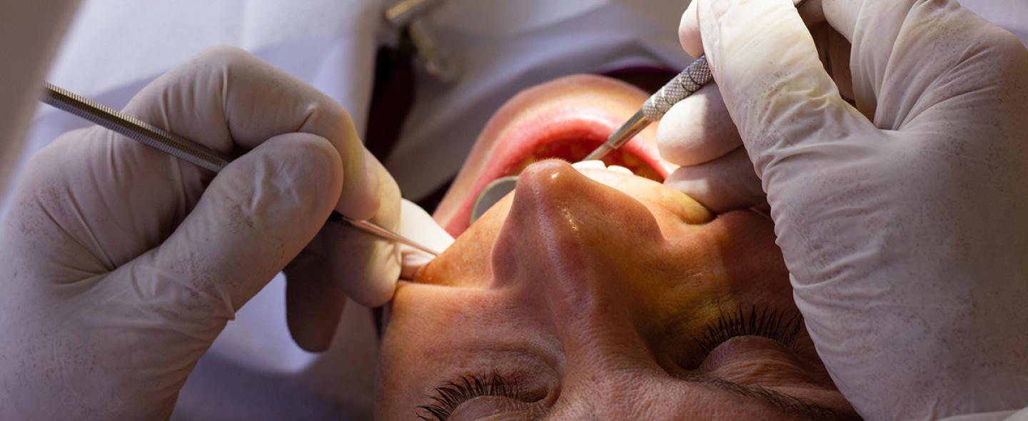 Potilasta hoidetaan hammaslääkärin vastaanotolla