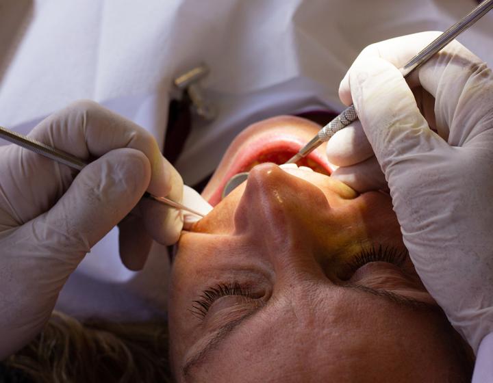 Potilasta hoidetaan hammaslääkärin vastaanotolla